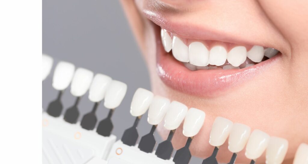 Teeth Whitening