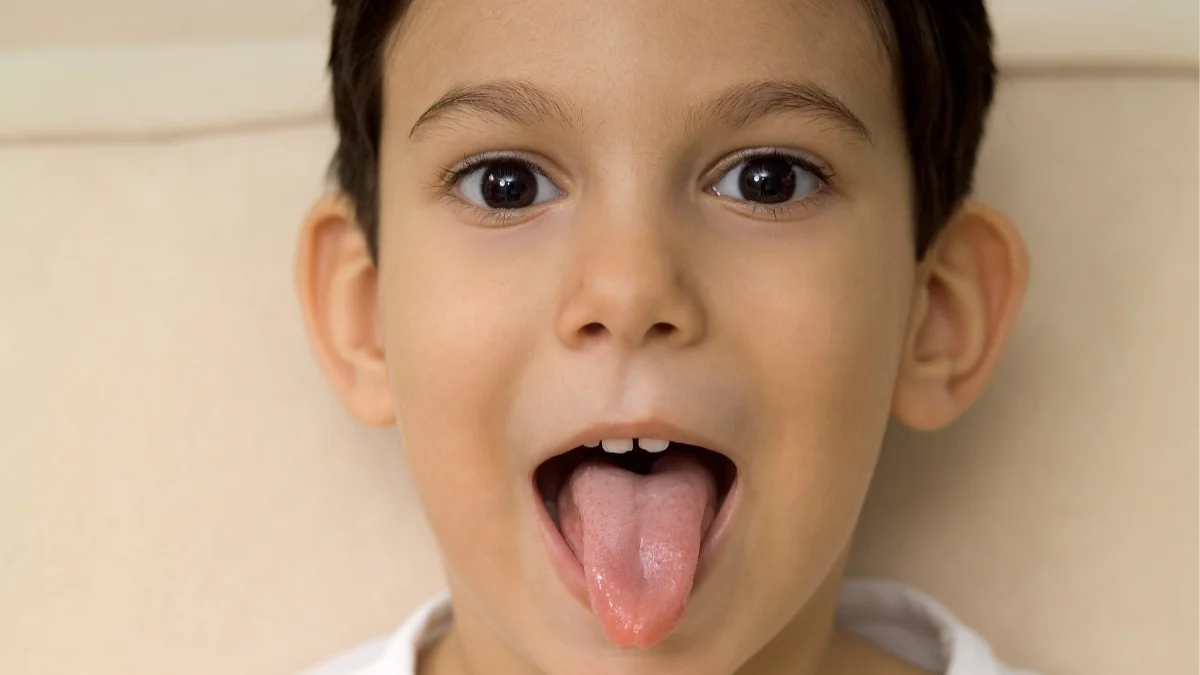 Child sticking out tongue to be examined by a dentist from Smiles by Choice in St. Louis.